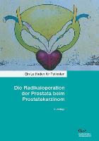 nervenregeneration nach prostata operation nervenregeneration nach prostata operation